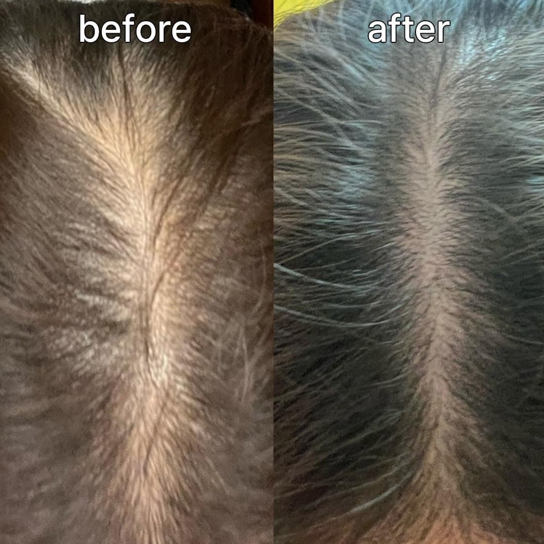 Split close-up of thinning scalp showing before and after improved coverage