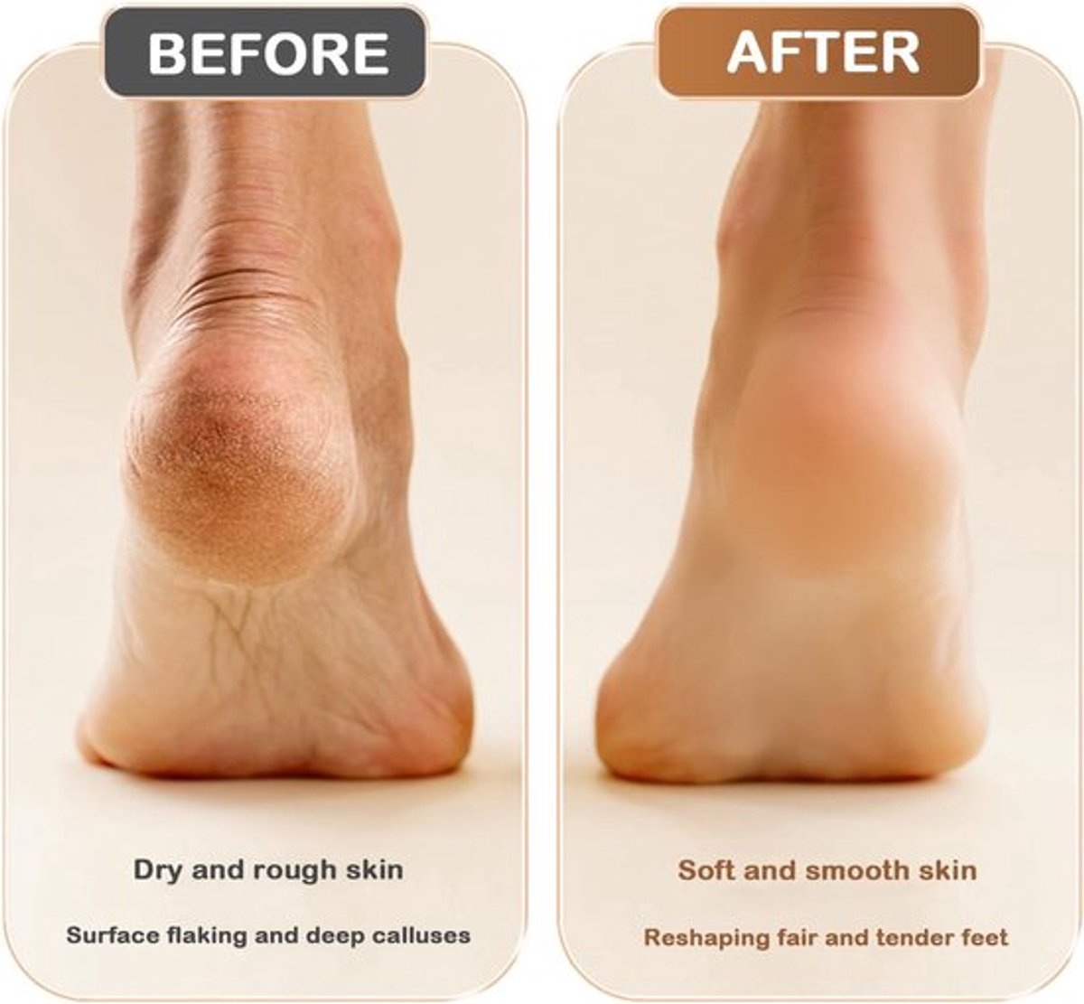 Electric Foot File - Removes Calluses and Dead Skin - Powerful Exfoliation - Built-in LED Light - Regenerative Exfoliation - Removes Calluses and Hard Skin - Wit