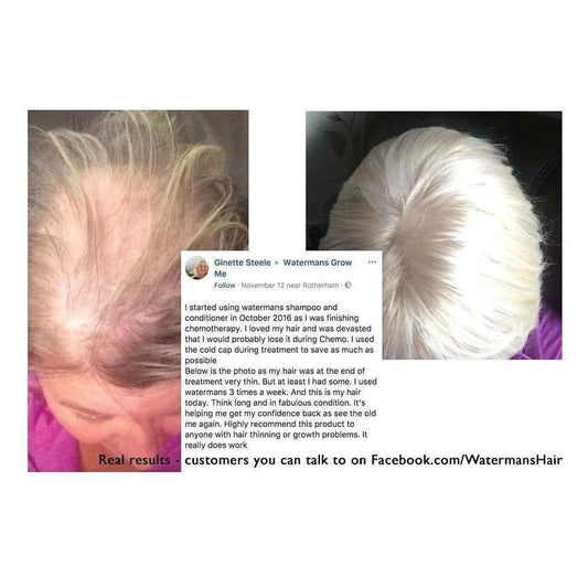 Conditioner-treated hair and scalp close-up, two result photos