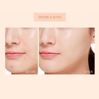 Before-and-after face concealer effect with blended coverage on skin.