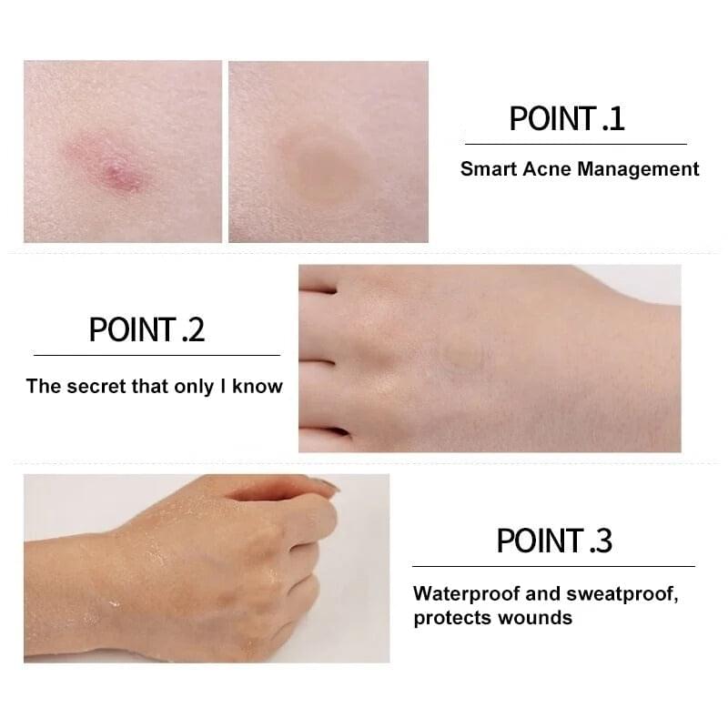 Acne relief spot patch use results illustration with skin close-ups and application notes