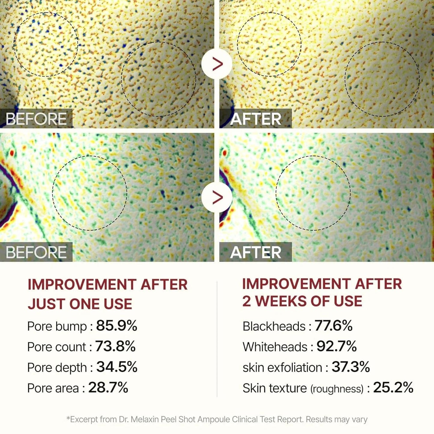 Clinical before-and-after skin panels with magnified circles and improvement metrics