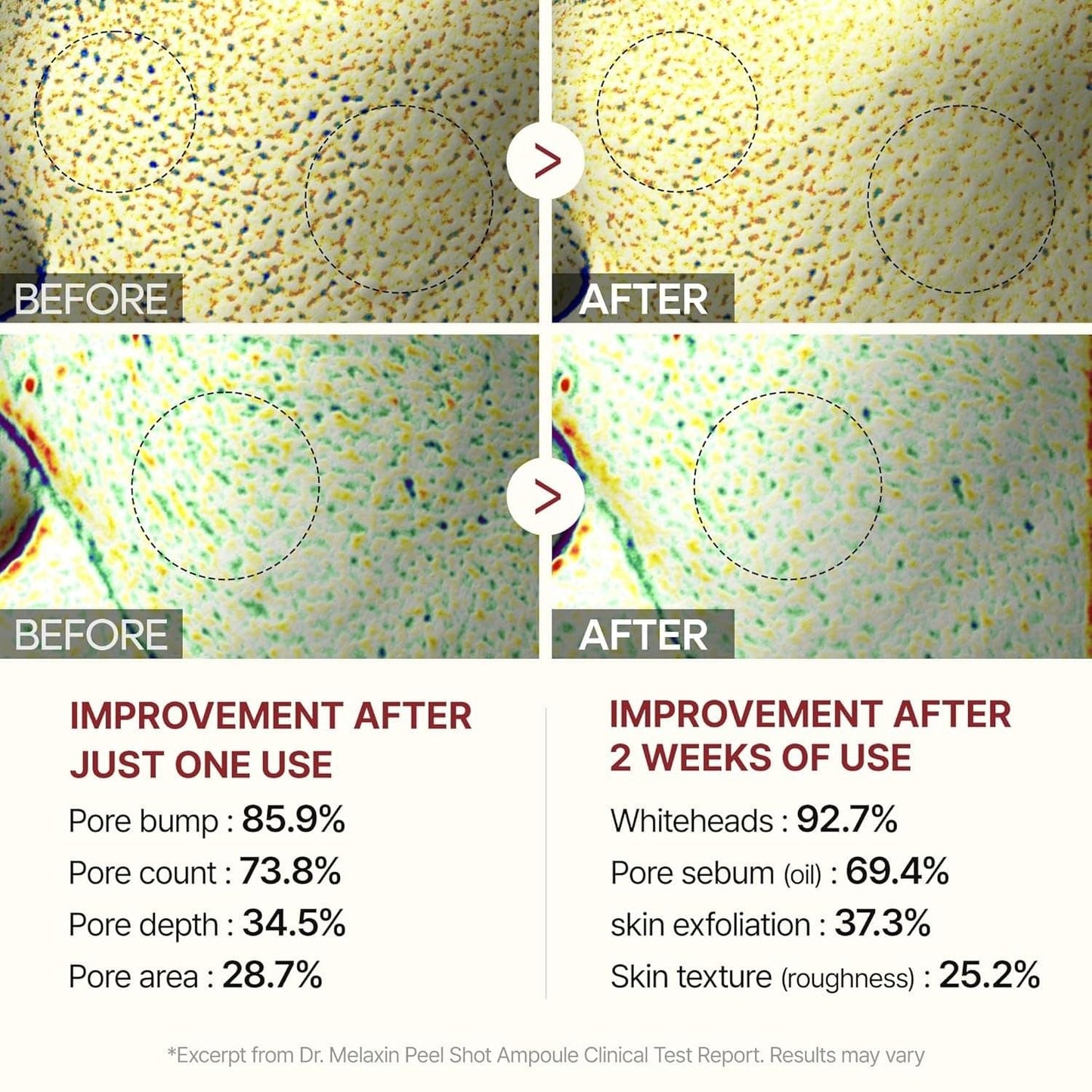 Microscope-style pore improvement chart comparing before and after use