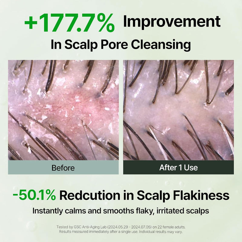 Scalp care before-and-after close-up showing reduced flaking after use.