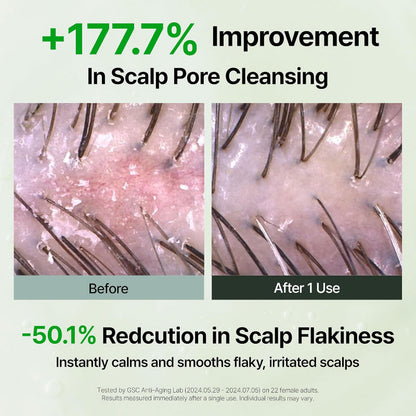 Scalp care before-and-after close-up showing reduced flaking after use.