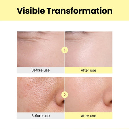 Serum results split view on face skin: before and after texture and pore appearance
