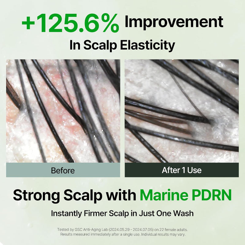 Scalp flakiness before-and-after close-up with smoother scalp after 1 use.