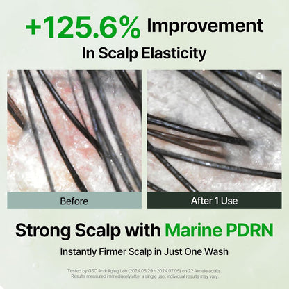 Scalp flakiness before-and-after close-up with smoother scalp after 1 use.