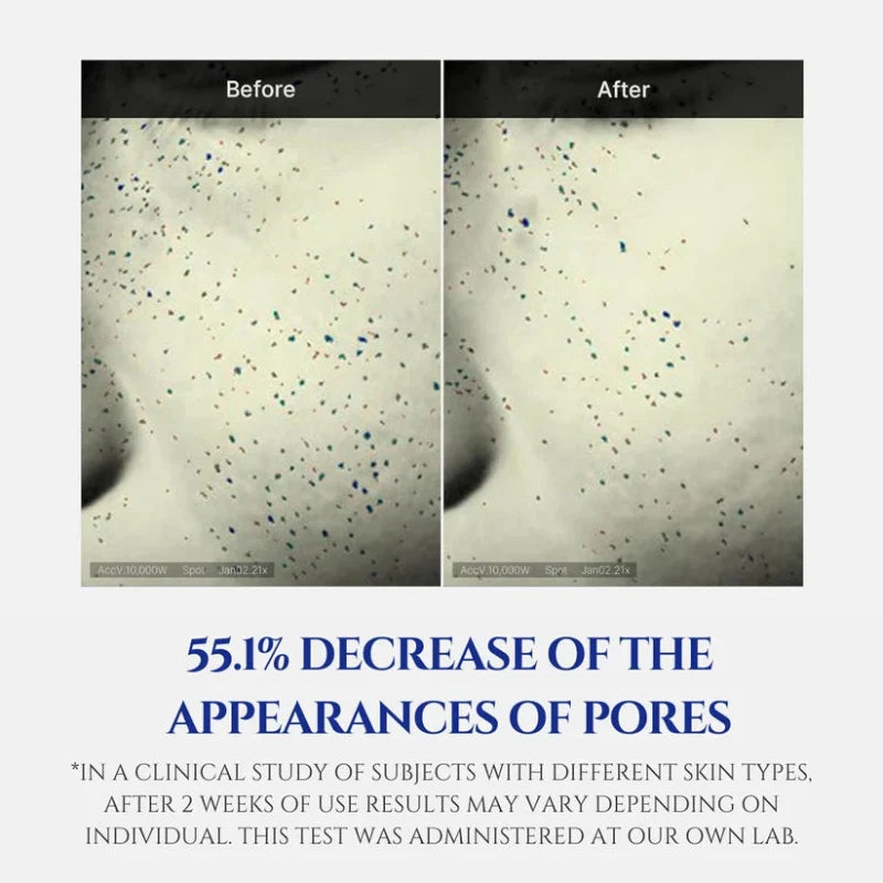 Cream product performance chart with “Before” and “After” pore appearance results