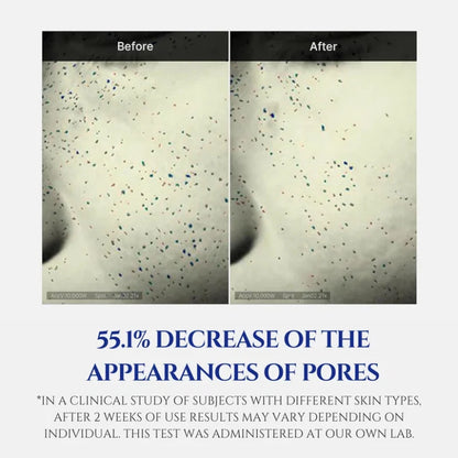Cream product performance chart with “Before” and “After” pore appearance results