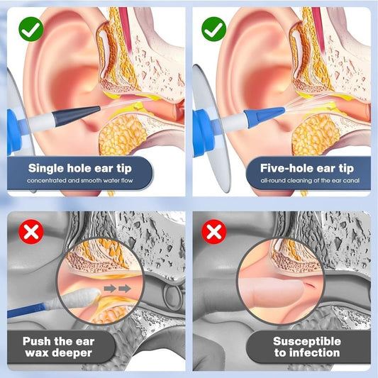 Ear irrigation tips shown for single-hole and five-hole cleaning near ear canal