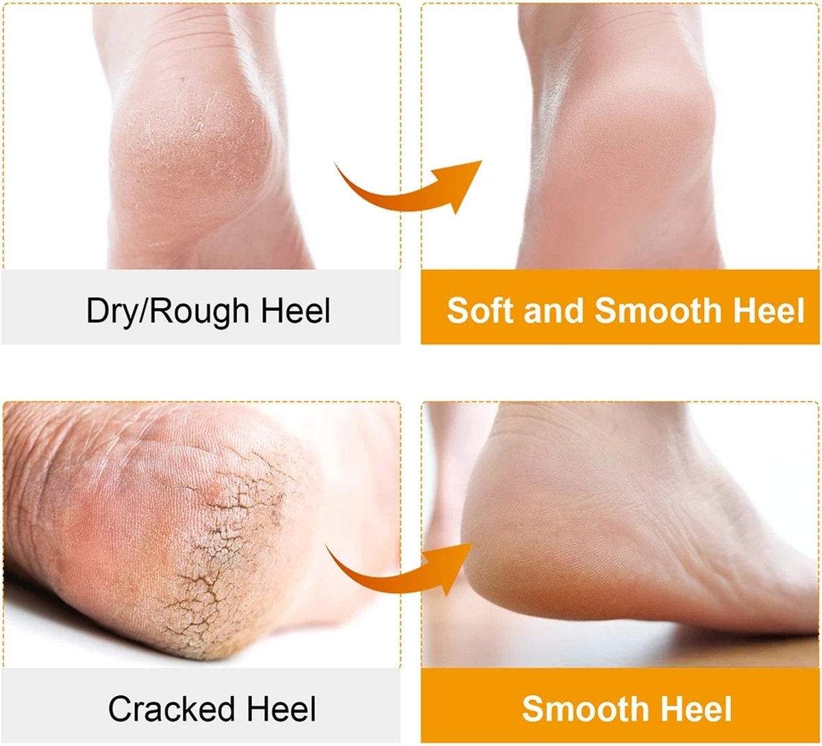 Pair Silicone Gel Socks | Heel Protectors | Heel Insoles | Heel Cushions | Heel Socks | One Size | Beige