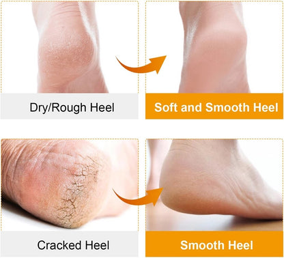 Pair Silicone Gel Socks | Heel Protectors | Heel Insoles | Heel Cushions | Heel Socks | One Size | Beige