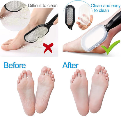 Professional Foot File - 2 Pieces - Callus File - Callus Rasp - Callus Shaver - Professional Callus Removers - Pedicure - Callus Rasp - Ergonomic Design - Stainless Steel - For Wet and Dry Use - Foot Care Callus - Callus Remover - Black and White