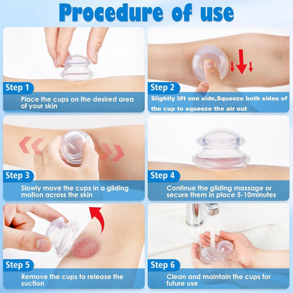 4 pieces silicone cups - Cupping cups - Cupping Set - Cellulite Cups - Cupping For Cellulite - vacuum cup - For reducing cellulite anti-aging relieves pain and joints for buttocks, neck, body - Green
