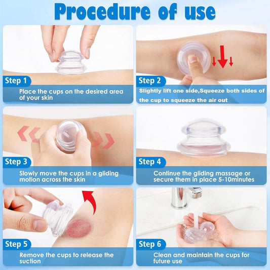 Cupping set procedure steps with silicone cups in hand