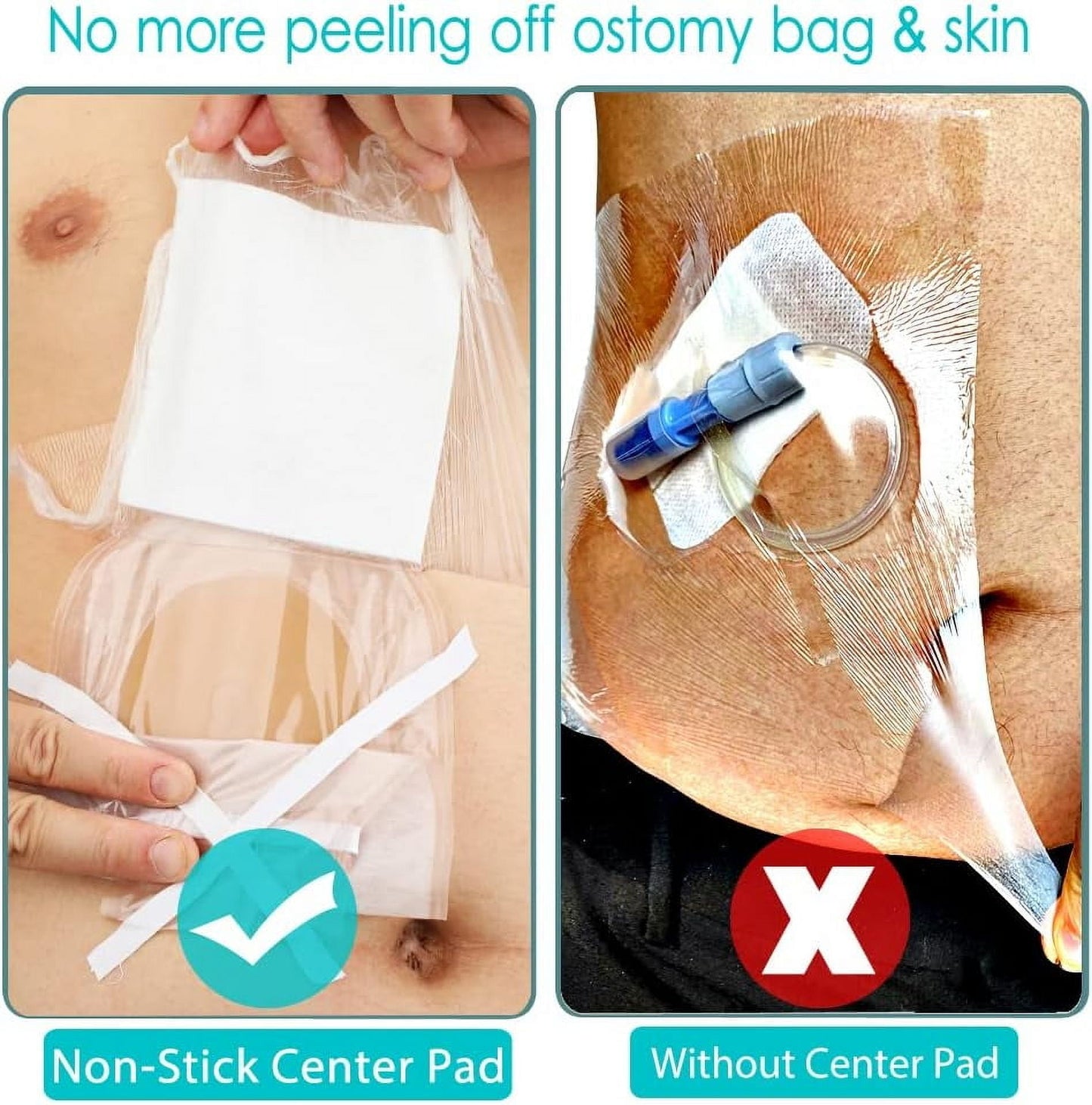 25 Pcs Waterproof Ostomy Shower Cover 8"x8" Stoma Bath Protector Shield Dressing Bandage for Colostomy Supply Pouch Guard Accessory 8x8 Inch (Pack of 25)
