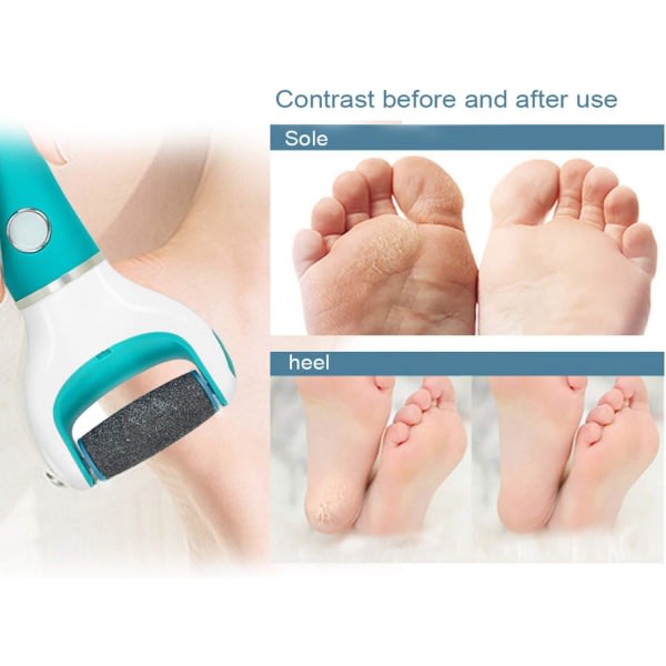 [9-pack] Scholl Velvet Smooth Pedi Replacement Rollers