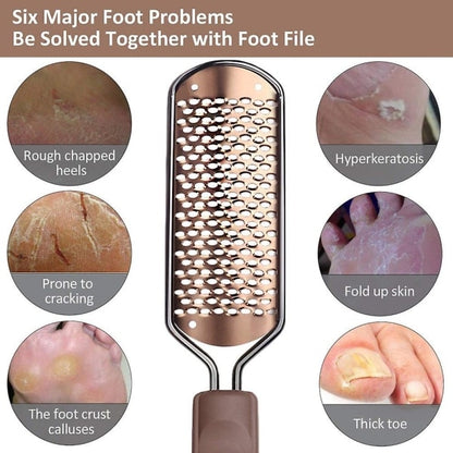Pedicure Foot File Hard Skin Remover - Large Foot Rasp Colossal Foot Scrub Professional Stainless Steel Hard File for Wet and Dry Feet