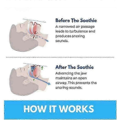 Honex Anti-Snoring Mouthpiece - Quite Night Device, Adjustable Jaw