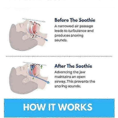 Honex Anti-Snoring Mouthpiece - Quite Night Device, PC+EVA