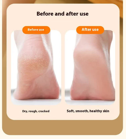 Electric Foot Callus Remover Rechargeable Pedicure Tool with 3 Grinding Heads Portable Dead Skin Exfoliator Ivory White