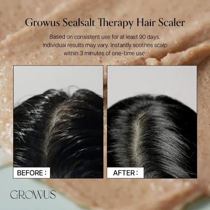 Split scalp photos showing before flaking and after smoother scalp