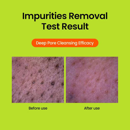 Beplain Cleansing Foam (80ml)