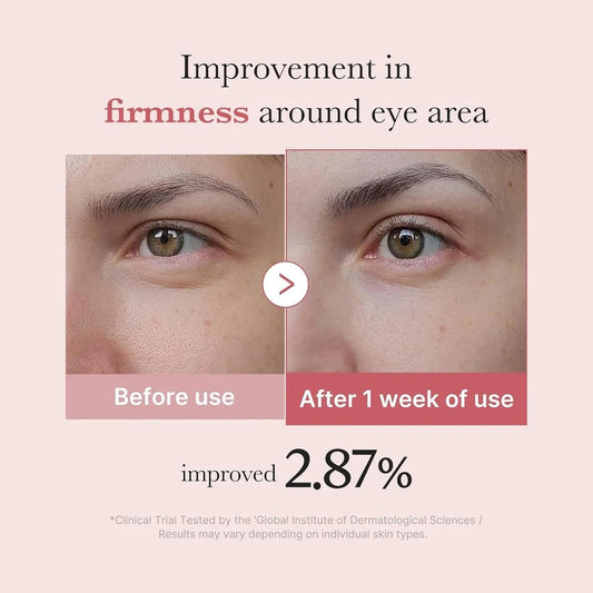 Eye area before-and-after results graphic for an eye cream, split-view faces.