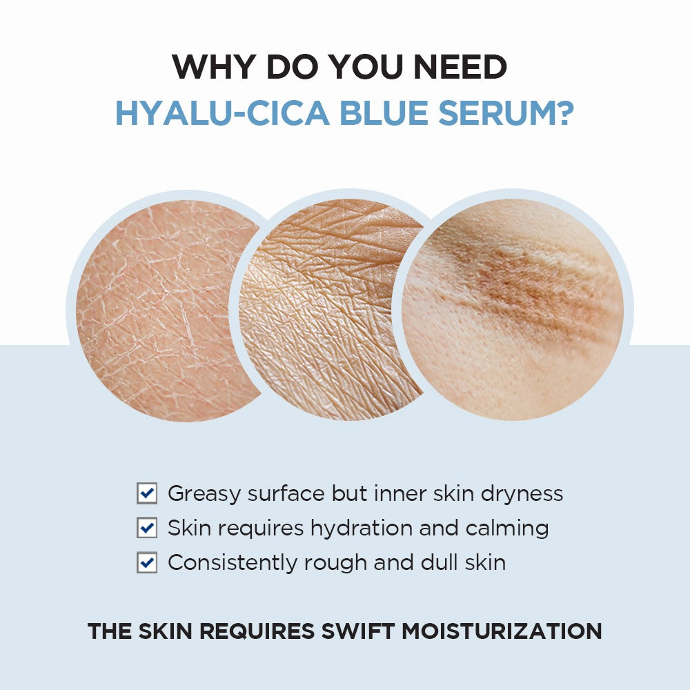 SKIN1004 Madagascar Centella Hyalu-Cica Blue Serum (50ml)