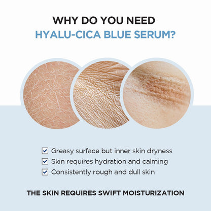 SKIN1004 Madagascar Centella Hyalu-Cica Blue Serum (50ml)