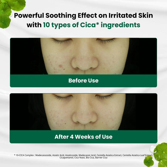Before-and-after face photos showing reduced blemish on skin